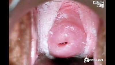 هڪ خوبصورت عورت جي Gynecological امتحان